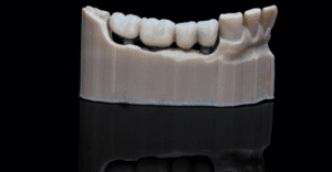 Dental Bridge - Emergency Dental of St. Louis